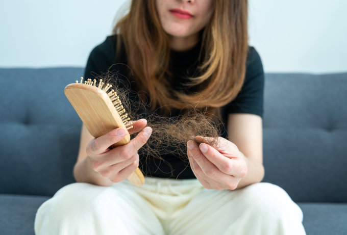 5大脫髮原因｜防脫髮洗頭水、健髮梳、生髮精華推薦！附高效防脫髮治療療程介紹