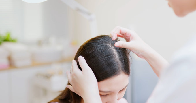 頭皮濕疹洗頭水推薦｜頭皮濕疹症狀+原因！10款濕疹都用得的防脫髮洗頭水是？